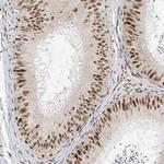 ZNF514 Antibody in Immunohistochemistry (IHC)