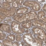 ZNF79 Antibody in Immunohistochemistry (Paraffin) (IHC (P))