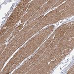 ZNF180 Polyclonal Antibody