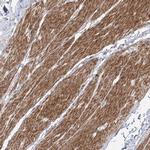 ZNF180 Antibody in Immunohistochemistry (IHC)