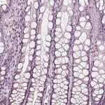 EGR4 Antibody in Immunohistochemistry (Paraffin) (IHC (P))