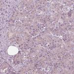 EGR4 Polyclonal Antibody
