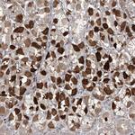 SAMD3 Antibody in Immunohistochemistry (IHC)