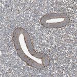 SAMD3 Antibody in Immunohistochemistry (Paraffin) (IHC (P))