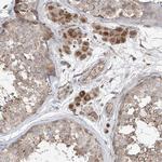 SAMD3 Antibody in Immunohistochemistry (Paraffin) (IHC (P))