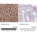 GLUT2 Antibody in Immunohistochemistry (IHC)