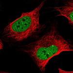 ZNF470 Polyclonal Antibody