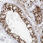 ZNF470 Antibody in Immunohistochemistry (Paraffin) (IHC (P))