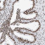 SRSF6 Polyclonal Antibody