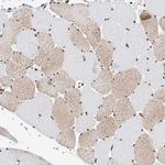 SRSF6 Antibody in Immunohistochemistry (IHC)