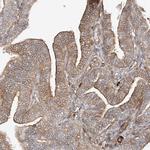 CSMD3 Antibody in Immunohistochemistry (Paraffin) (IHC (P))
