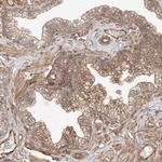 CSMD3 Antibody in Immunohistochemistry (Paraffin) (IHC (P))