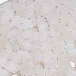 CSMD3 Antibody in Immunohistochemistry (Paraffin) (IHC (P))