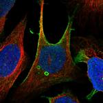 ZFP90 Polyclonal Antibody