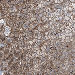 ZFP90 Antibody in Immunohistochemistry (Paraffin) (IHC (P))