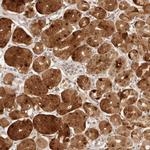 CPSF3L Antibody in Immunohistochemistry (IHC)