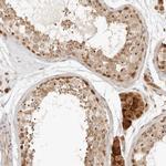 CPSF3L Antibody in Immunohistochemistry (IHC)