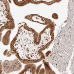 CPSF3L Antibody in Immunohistochemistry (IHC)