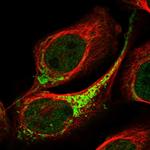 ETHE1 Polyclonal Antibody