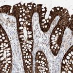 ETHE1 Antibody in Immunohistochemistry (Paraffin) (IHC (P))