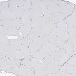 ETHE1 Antibody in Immunohistochemistry (Paraffin) (IHC (P))