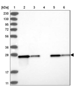 ETHE1 Antibody in Western Blot (WB)