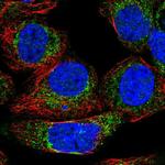 KHDC1 Polyclonal Antibody