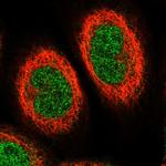 ETV7 Polyclonal Antibody