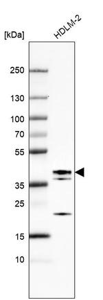 ETV7 Antibody in Western Blot (WB)