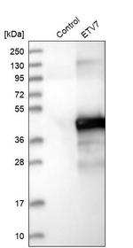 ETV7 Antibody in Western Blot (WB)