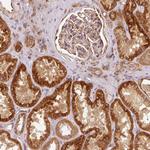 MTHFD1L Polyclonal Antibody