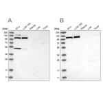 MTHFD1L Antibody in Western Blot (WB)