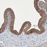 NRBP2 Polyclonal Antibody