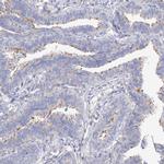 LCA5 Polyclonal Antibody