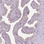 LCA5 Polyclonal Antibody