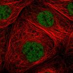 ZNF354B Polyclonal Antibody