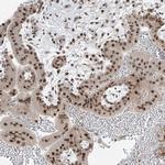 ZNF354B Antibody in Immunohistochemistry (Paraffin) (IHC (P))