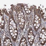 NT5C3A Polyclonal Antibody