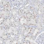 AP000322.53 Antibody in Immunohistochemistry (Paraffin) (IHC (P))