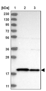 TIMM17B Antibody in Western Blot (WB)