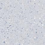 RGN Antibody in Immunohistochemistry (IHC)