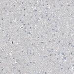 RGN Antibody in Immunohistochemistry (IHC)