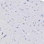 C1orf85 Antibody in Immunohistochemistry (Paraffin) (IHC (P))
