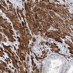 C1orf85 Antibody in Immunohistochemistry (Paraffin) (IHC (P))