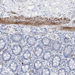 C1orf85 Polyclonal Antibody