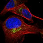 HSD17B13 Polyclonal Antibody