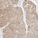 WFS1 Antibody in Immunohistochemistry (IHC)