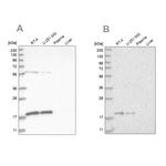MRPS10 Antibody in Western Blot (WB)