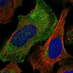 RAB23 Polyclonal Antibody