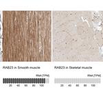 RAB23 Antibody in Immunohistochemistry (IHC)